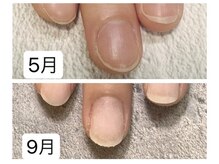 グラシナ 鳥丸店/爪の形も綺麗に