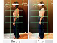 東船橋スタンス整体院/20代教師の利用者様