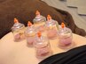 【肩こり/腰痛/疲労回復】鍼灸マッサージ×カッピング　60分8000円