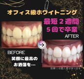 ホワイトニングプラス(Whitening+)