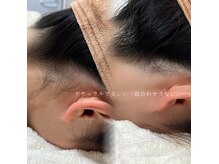 アトリーチェ ベレッツァ(ATTRICE Bellezza)の雰囲気（シェービング×うなじ×顔 人気です♪）