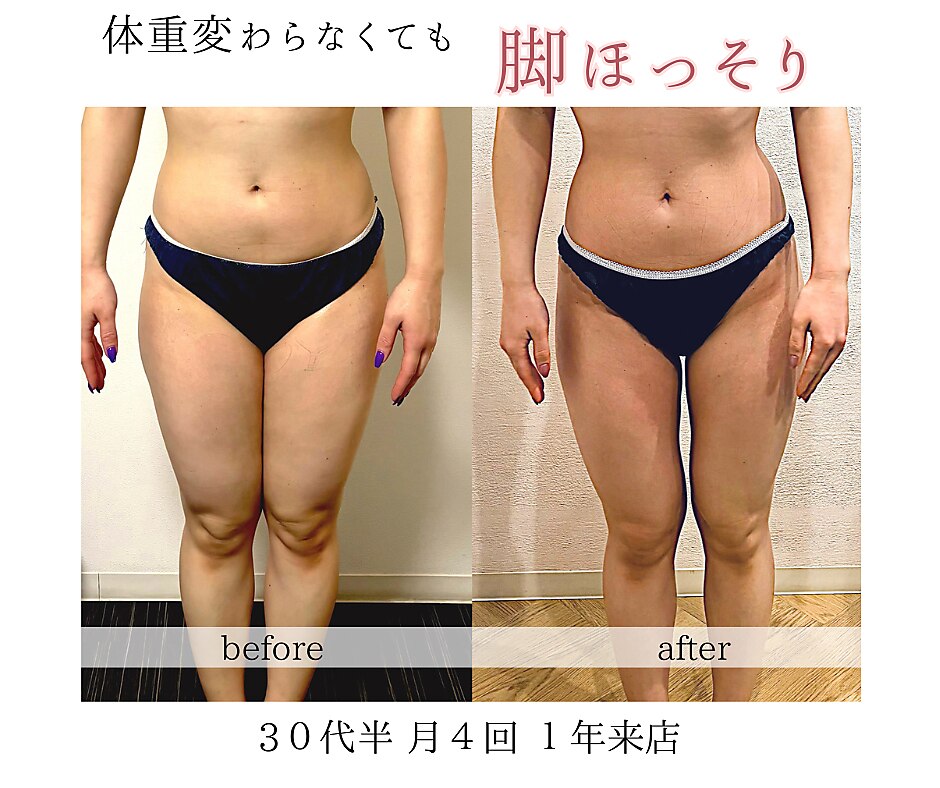 大阪市淀川区でキャビテーションが人気のエステサロン｜ホットペッパー
