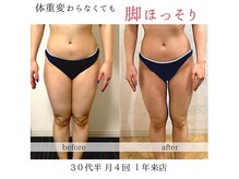 エステサロンクオーツ