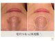 エステ ココ 荻窪店(Esthe CoCo)の写真