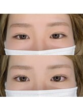 プペ(Pupe)/ラッシュリフト