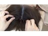 【抜け毛・薄くなった毛髪にハリ艶のある育毛を促進】美髪鍼スカルプケア　