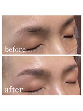 ブリリアント(brilliant)/ハリウッドブロウリフト