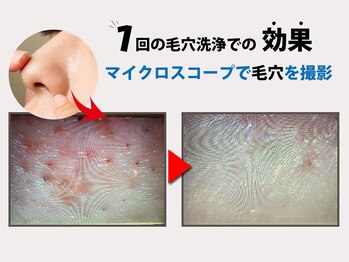 VS28スキンケアスタジオ バリイン 大宮(BALI IN)/【毛穴洗浄ケア】20年以上の実績