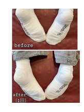 小顔22 ボルティ 赤坂支店(Bolty)/【悩み】股関節・骨盤の歪み