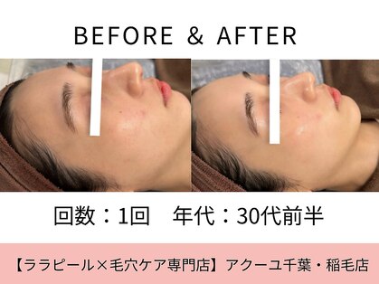 ア クーユ 稲毛店の写真