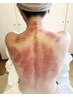【当店人気No.1☆】慢性肩こり＆疲労丸ごとすっきりデトックスコース