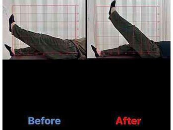 美田園5丁目接骨院/下半身ストレッチbefore⇒after