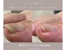 【フットケア】巻き爪/トラブル予防ケア　70分　¥6.500