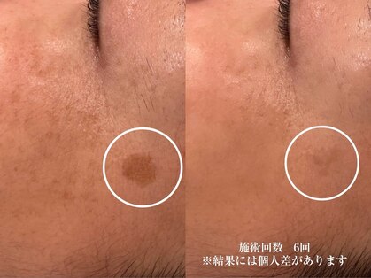 ナンバー19(N°19)の写真