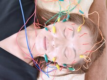 美容針:表現筋、ツボ、リンパの流れ改善