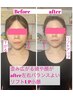 【整体マッサージ一時しのぎから卒業】小顔×全身バランス矯正初回体験！9800
