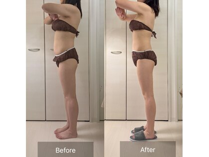 エーソワン(a'soin)の写真