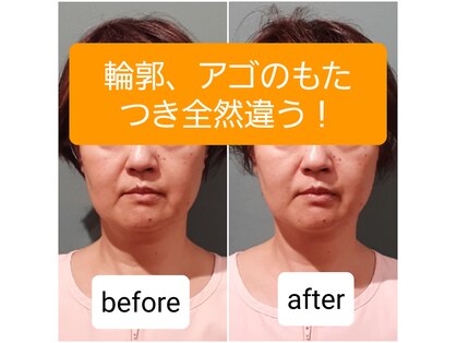 エルアンドエス(L&S)の写真