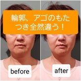 エルアンドエス(L&S)