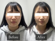 ベルフィーヌ 恵比寿店(BELFINE)/BELFINEオリジナル造形小顔