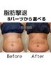 【脂肪撃退】気になる部分を徹底的に！1パーツ4980円 40分