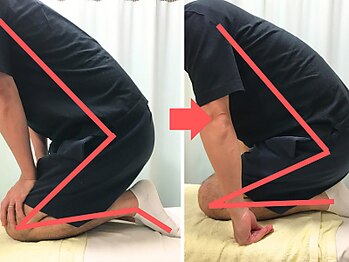 杉本接骨鍼灸院/膝の症状例:施術を受けた方の声