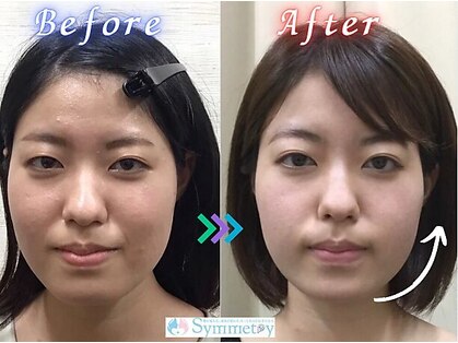 フェイスラインプラス 銀座店(FACELINE+)の写真