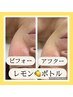 話題の脂肪分解・小顔☆フェイス+デコルテマッサージ+レモンボトル¥9800