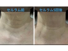 フレア(FULEA)/セルラム