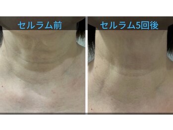 フレア(FULEA)/セルラム