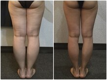 美容整体 ウェリナ 蟹江院/小顔矯正/骨盤矯正/美脚サロン