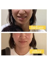 スパ 香炉/GUINOT美容機器VARフェイシャル