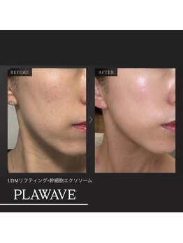 ラグ(LUXU)の写真/《艶肌小顔を目指すならLUXUに!》お顔の筋肉をほぐしてキュッと引き締め◎艶肌と小顔を同時に叶えることも!
