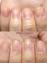 マリーロール 淀屋橋本店(Marie Laure)/自爪育成/深爪矯正/ネイルケア