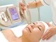 ミーカラー(mecalla.)の写真/医療機関と提携◎若々しい見た目/印象×小顔に！持続性も抜群◎次世代オーガニック脂肪分解剤注入！