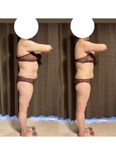 カシェット(cachette)/ウルトランスフォーマー痩身