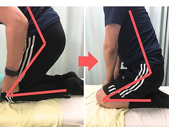 杉本接骨鍼灸院/膝の症状例:施術を受けた方の声