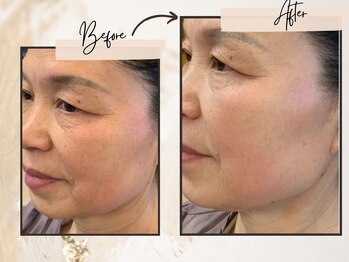 コンビンス(convince)/お客様の年齢代は幅広く