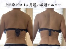 シーフェイス 横浜店(SEE FACE)/上半身ゼロダイエットモニター様