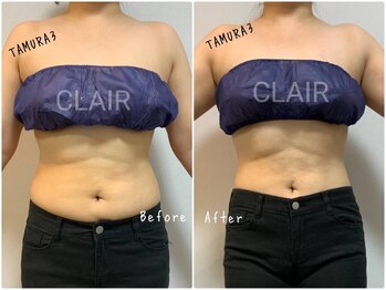 クレール(CLAIR)/痩身マシンTAMURA3