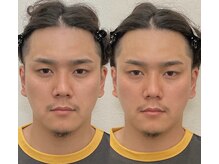 小顔22 ボルティ 本店(Bolty)/施術:河野式小顔輪郭矯正術