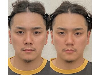 小顔22 ボルティ 本店(Bolty)/施術:河野式小顔輪郭矯正術