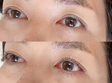 “目元の変化＝老け見え”を、たった1日で変える施術。