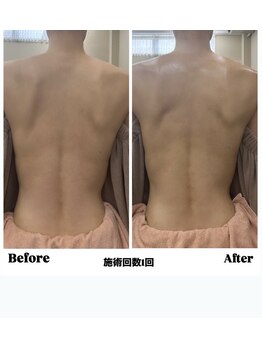 イセラ(ISELA)/全身リンパマッサージ