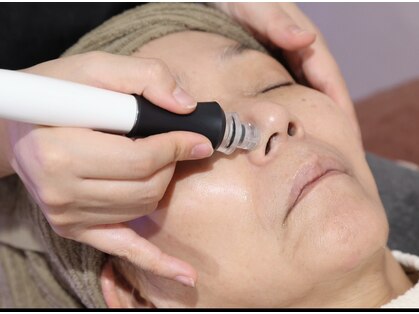 アランクォーツ(aranquarts)の写真