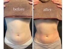 リノレア(Lino_Lea)