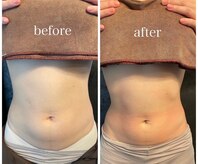 リノレア(Lino_Lea)