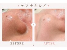 パールプラス 大垣店(Pearl plus)/毛穴汚れが浮き出る！！