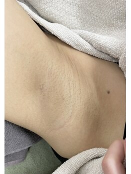 ナノハナ/鹿沼市全身脱毛美容室ナノハナ