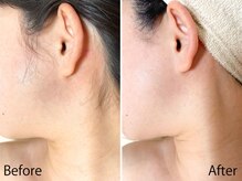 ライトウェーブ 松本村井本店/仕上がりにこだわる顔脱毛